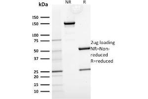 SDS-PAGE Analysis Purified Cytokeratin 15 Mouse Monoclonal Antibody (KRT15/2554).