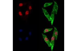ABIN6262989 and ABIN6273053 staining Hela cells by IF/ICC. (Lamin B2 anticorps  (Internal Region))