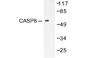 Image no. 1 for anti-Caspase 8 (CASP8) antibody (ABIN271875) (Caspase 8 anticorps)
