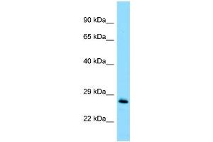 WB Suggested Anti-MOB1A Antibody Titration: 1. (MOB1A anticorps  (Middle Region))
