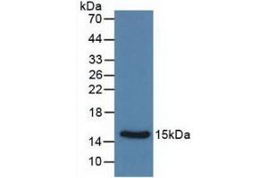 Detection of Recombinant Calcitonin, Rat using Monoclonal Antibody to Calcitonin (CT) (Calcitonin anticorps  (AA 85-116))