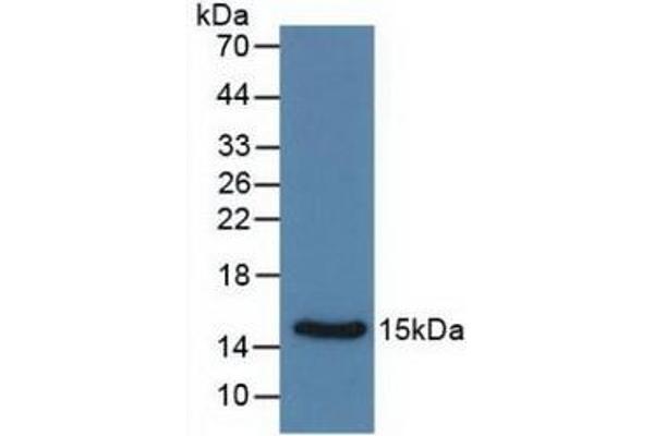 Calcitonin anticorps  (AA 85-116)
