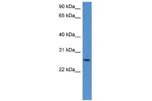 WB Suggested Anti-Chodl Antibody Titration: 0. (CHODL anticorps  (C-Term))