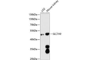 Western blot analysis of extracts of various cell lines, using SLC7 antibody (ABIN6130697, ABIN6148048, ABIN6148049 and ABIN6216625) at 1:3000 dilution.