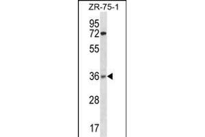 XRCC2 Antibody (N-term) (ABIN1882001 and ABIN2838361) western blot analysis in ZR-75-1 cell line lysates (35 μg/lane). (XRCC2 anticorps  (N-Term))