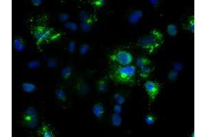 Anti-Nog mouse monoclonal antibody (ABIN2452361) immunofluorescent staining of COS7 cells transiently transfected by pCMV6-ENTRY Nog (RC205020). (NOG anticorps  (AA 28-232))