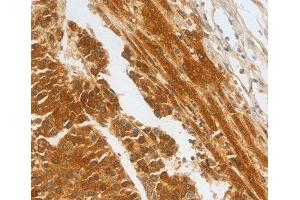 Immunohistochemistry (IHC) image for anti-Complement Factor H-Related 1 (CFHR1) (AA 151-330) antibody (ABIN6219787) (CFHR1 anticorps  (AA 151-330))