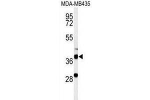 Western Blotting (WB) image for anti-Dehydrogenase/reductase (SDR Family) Member 7 (DHRS7) antibody (ABIN3002129) (DHRS7 anticorps)