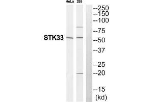 Western Blotting (WB) image for anti-serine/threonine Kinase 33 (STK33) (N-Term) antibody (ABIN1852726) (STK33 anticorps  (N-Term))