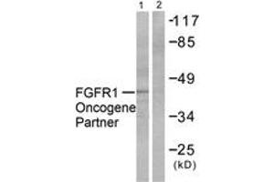 Western blot analysis of extracts from HepG2 cells, using FGFR1 Oncogene Partner Antibody. (FGFR1OP anticorps  (AA 341-390))