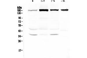 Western blot analysis of IQGAP2 using anti-IQGAP2 antibody . (IQGAP2 anticorps  (AA 1329-1544))