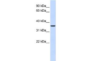 WB Suggested Anti-FBP2 Antibody Titration:  0. (FBP2 anticorps  (Middle Region))