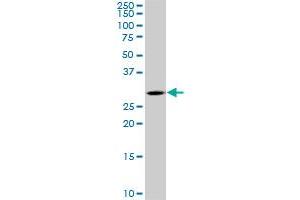 TGIF2 monoclonal antibody (M03), clone 5G1. (TGIF2 anticorps  (AA 131-236))