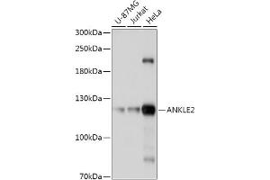 Western blot analysis of extracts of various cell lines, using  antibody (ABIN7265603) at 1:1000 dilution. (ANKLE2 anticorps  (AA 350-450))