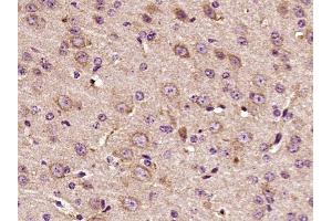 Paraformaldehyde-fixed, paraffin embedded mouse brain, Antigen retrieval by boiling in sodium citrate buffer (pH6) for 15min, Block endogenous peroxidase by 3% hydrogen peroxide for 30 minutes,  Blocking buffer (normal goat serum) at 37°C for 20min, Antibody incubation with HER3 (Tyr1289) Polyclonal Antibody(bs-3491R) at 1:400 overnight at 4°C, followed by a conjugated secondary and DAB staining.