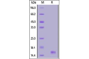 Human GDF-15, His Tag on  under reducing (R) condition. (GDF15 Protein (AA 197-308) (His tag))