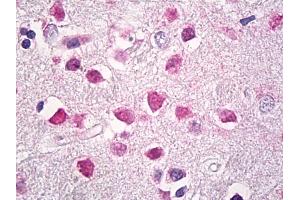 Anti-HMG1 / HMGB1 antibody IHC of human brain, cortex. (HMGB1 anticorps)