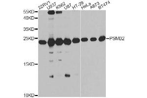 Western blot analysis of extracts of various cell lines, using PSMB2 antibody (ABIN6291444) at 1:1000 dilution.