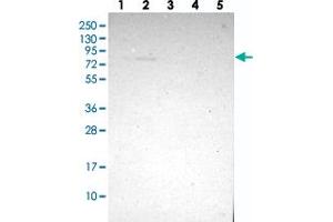 Western blot analysis of Lane 1: RT-4, Lane 2: U-251 MG, Lane 3: Human Plasma, Lane 4: Liver, Lane 5: Tonsil with ZMAT1 polyclonal antibody . (ZMAT1 anticorps)
