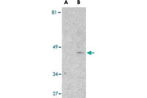 Western blot analysis of Il1rl1 in mouse kidney lysate with Il1rl1 polyclonal antibody  at 1 ug/mL in the presence (lane A) or absence (lane B) of 1 ug blocking peptide.