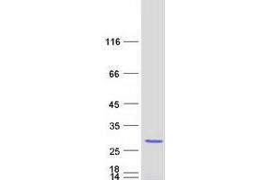 Nucleolar Protein 16 (NOP16) protein (Myc-DYKDDDDK Tag)