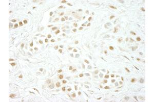 Immunohistochemistry (IHC) image for anti-Cyclin C (CCNC) (AA 244-294) antibody (ABIN7448506)