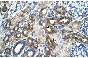 Rabbit Anti-PKLR Antibody ,Paraffin Embedded Tissue: Human Kidney  Cellular Data: Epithelial cells of renal tubule  Antibody Concentration: 4.