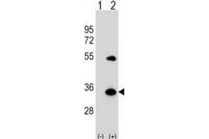 Western Blotting (WB) image for anti-ATG5 Autophagy Related 5 (ATG5) antibody (ABIN2999975) (ATG5 anticorps)
