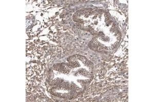 Immunohistochemical staining of human corpus, uterine with CRIP3 polyclonal antibody  shows moderate membranous and cytoplasmic positivity in glandular cells. (CRIP3 anticorps)