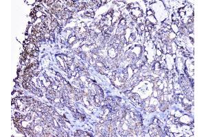IHC analysis of cortactin using anti-cortactin antibody (ABIN6719306). (Cortactin anticorps  (AA 1-105))
