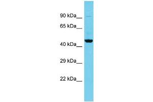Host: Rabbit Target Name: C5orf45 Sample Type: Fetal Kidney lysates Antibody Dilution: 1. (MRNIP/C5ORF45 anticorps  (N-Term))