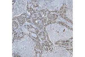 IHC analysis of TRMT6 using anti-TRMT6 antibody (ABIN7602138). (TRMT6 anticorps  (AA 6-489))