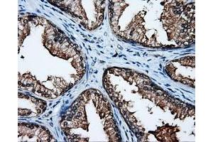 Immunohistochemical staining of paraffin-embedded colon tissue using anti-APP mouse monoclonal antibody. (APP anticorps)