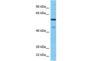 Host:  Rabbit  Target Name:  NEK11  Sample Type:  721_B Whole Cell lysates  Antibody Dilution:  1. (NEK11 anticorps  (Middle Region))