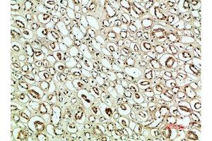 Immunohistochemical analysis of paraffin-embedded human-kidney, antibody was diluted at 1:200 (PLK2 anticorps  (AA 1268-1341))