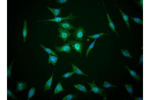 Immunofluorescent staining of human cell lines (TAZ anticorps)