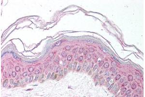 Human Skin (formalin-fixed, paraffin-embedded) stained with MDH1 antibody ABIN291679 at 5 ug/ml followed by biotinylated secondary antibody, alkaline phosphatase-streptavidin and chromogen. (MDH1 anticorps)