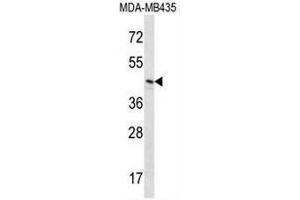 RNH1 Antibody (C-term) western blot analysis in MDA-MB435 cell line lysates (35µg/lane). (RNH1 anticorps  (C-Term))