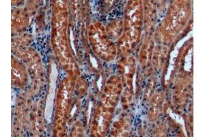 Detection of GLa in Human Kidney Tissue using Monoclonal Antibody to Galactosidase Alpha (GLa)