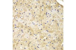 Immunohistochemistry (IHC) image for anti-Isocitrate Dehydrogenase 1 (NADP+), Soluble (IDH1) (AA 1-414) antibody (ABIN3023106)