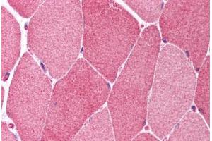 Human Skeletal Muscle (formalin-fixed, paraffin-embedded) stained with BCL10 antibody ABIN214608 at 10 ug/ml followed by biotinylated goat anti-rabbit IgG secondary antibody ABIN481713, alkaline phosphatase-streptavidin and chromogen. (BCL10 anticorps  (AA 5-19))