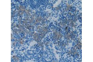 Used in DAB staining on fromalin fixed paraffin- embedded Kidney tissue (IL-2 anticorps  (AA 21-155))