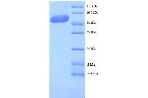 Mannose-6-Phosphate Receptor (Cation Dependent) (M6PR) (AA 1-277), (full length) protein (GST tag)