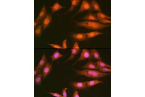 Immunofluorescence analysis of NIH-3T3 cells using PP1 beta Rabbit mAb (ABIN1679819, ABIN3018859, ABIN3018860 and ABIN7101675) at dilution of 1:100 (40x lens).