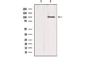 Western blot analysis of extracts from 293, using ATP2A1 Antibody. (ATP2A1/SERCA1 anticorps  (Internal Region))