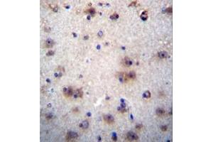 Formalin fixed and paraffin embedded human brain tissue reacted with EVPLL Antibody (Center) followed by peroxidase conjugation of the secondary antibody and DAB staining. (Envoplakin-Like anticorps  (Middle Region))