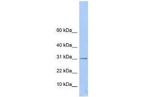 ECHDC1 antibody used at 1 ug/ml to detect target protein. (ECHDC1 anticorps  (Middle Region))