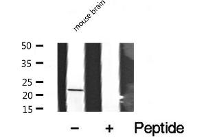 Western blot analysis of extracts from mouse Brian, using CRP1 antibody.