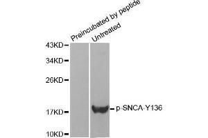 Western Blotting (WB) image for anti-Synuclein, alpha (SNCA) (pTyr136) antibody (ABIN1682064) (SNCA anticorps  (pTyr136))