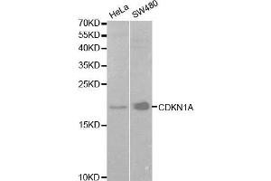 Western blot analysis of extracts of various cell lines, using CDKN1A antibody. (p21 anticorps  (AA 43-142))